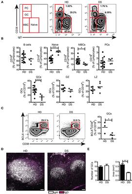 Dysregulated miR-155 and miR-125b Are Related to Impaired B-cell Responses in Down Syndrome